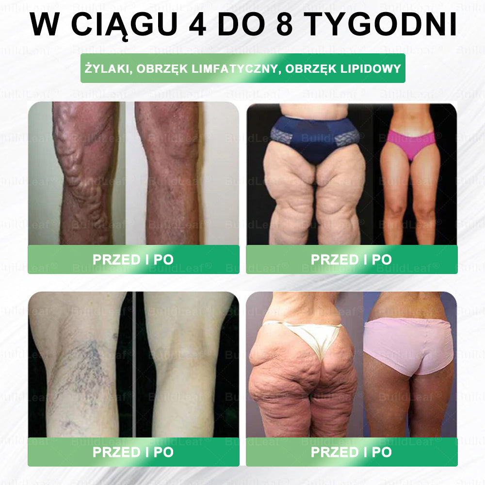 💥Oficjalny sklep Polska | BuildLeaf® GLP-1 8-w-1 Fit & Vital Rozwiązanie (Jednorazowe dziennie, widoczne zmiany w ciągu 7 dni) ✅ Otyłość, zdrowie sercowo-naczyniowe, cukrzyca, bezdech senny, zdrowie jelit, problemy ze stawami i inn）