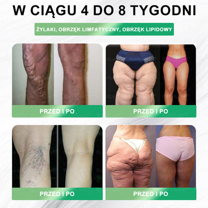 💥Oficjalny sklep Polska | BuildLeaf® GLP-1 8-w-1 Fit & Vital Rozwiązanie (Jednorazowe dziennie, widoczne zmiany w ciągu 7 dni) ✅ Otyłość, zdrowie sercowo-naczyniowe, cukrzyca, bezdech senny, zdrowie jelit, problemy ze stawami i inn）